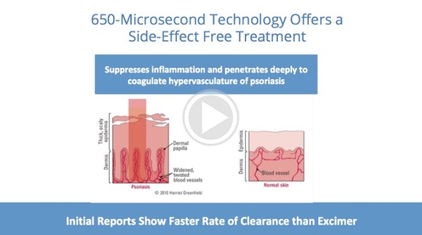 psoriasis webinar-3